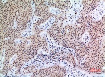p57 rabbit pAb Antibody