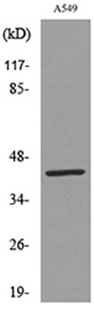 Cytokeratin 19 rabbit pAb Antibody