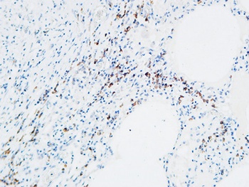 MPO rabbit pAb Antibody