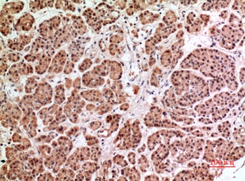 HPA1 rabbit pAb Antibody