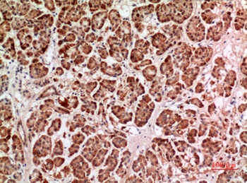 HPA1 rabbit pAb Antibody