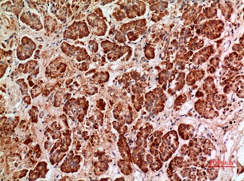 HPA1 rabbit pAb Antibody