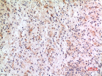 Fractalkine rabbit pAb Antibody