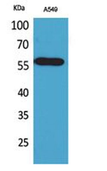 ALDH2 rabbit pAb Antibody
