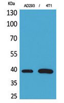 Troponin T-C rabbit pAb Antibody