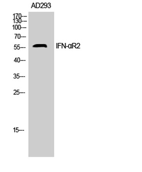 IFN-αR2 rabbit pAb Antibody