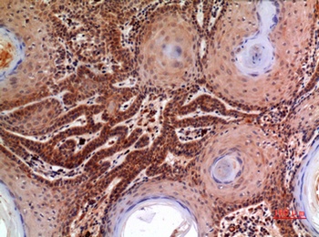 Macroglobulin α-2 rabbit pAb Antibody