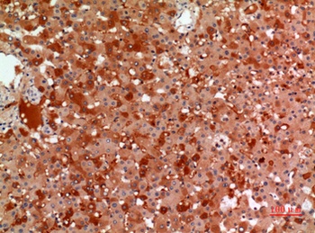 Macroglobulin α-2 rabbit pAb Antibody