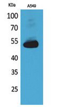 Annexin VII rabbit pAb Antibody