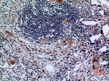 CD71/TfR rabbit pAb Antibody