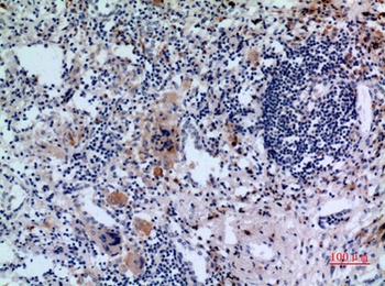 CD71/TfR rabbit pAb Antibody