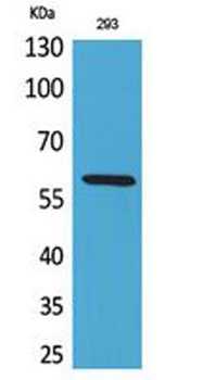 ALPP/ALPPL2 rabbit pAb Antibody