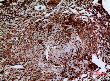 Laminin γ-2 rabbit pAb Antibody
