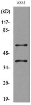 IL-2Rγ rabbit pAb Antibody
