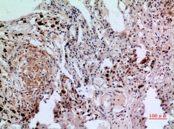 NFATc1 rabbit pAb Antibody
