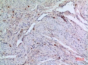 RFC1 rabbit pAb Antibody