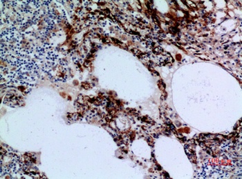 17β-HSD4 rabbit pAb Antibody