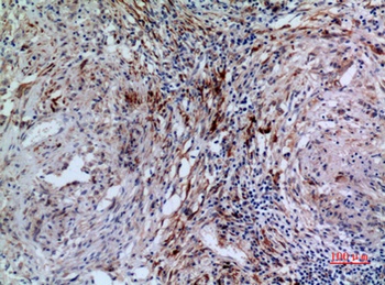 17β-HSD4 rabbit pAb Antibody