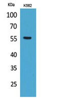 Glut5 rabbit pAb Antibody