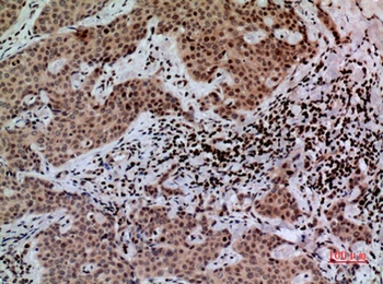 CacyBP rabbit pAb Antibody