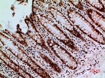 CacyBP rabbit pAb Antibody