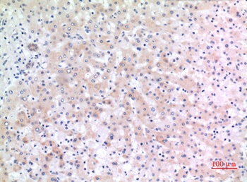 CD166 rabbit pAb Antibody