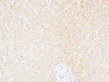 CD166 rabbit pAb Antibody