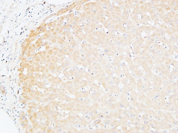 CD166 rabbit pAb Antibody