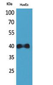 IL-8Rβ rabbit pAb Antibody