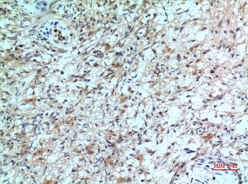 IL-8Rβ rabbit pAb Antibody
