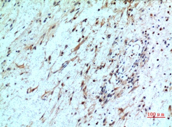 IL-8Rβ rabbit pAb Antibody