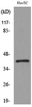 IL-8Rβ rabbit pAb Antibody