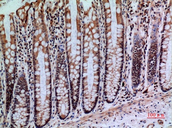 CD148 rabbit pAb Antibody