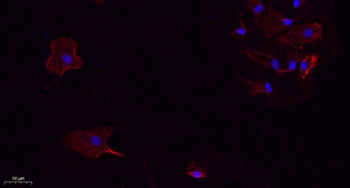 RANKL rabbit pAb Antibody