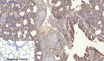 RANKL rabbit pAb Antibody