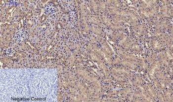 RANKL rabbit pAb Antibody