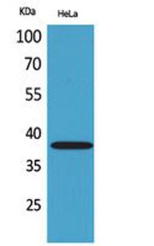 CD158b2/j rabbit pAb Antibody