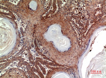 Inhibin β-B rabbit pAb Antibody