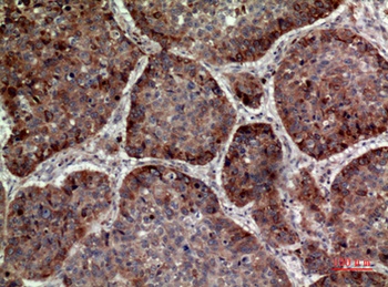 MDA-7 rabbit pAb Antibody