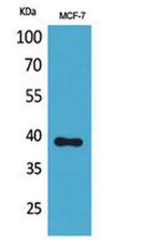 Nov rabbit pAb Antibody
