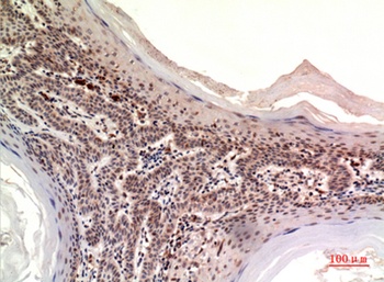 Nov rabbit pAb Antibody