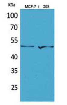 PD-ECGF rabbit pAb Antibody