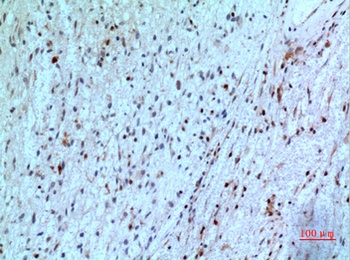 PD-ECGF rabbit pAb Antibody