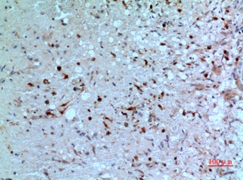 PD-ECGF rabbit pAb Antibody