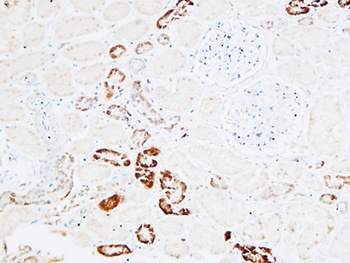 PD-ECGF rabbit pAb Antibody