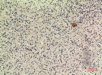 IFN-ω rabbit pAb Antibody