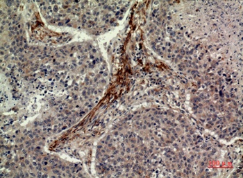 IDH1 rabbit pAb Antibody