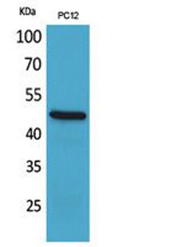 FOXP3 rabbit pAb Antibody
