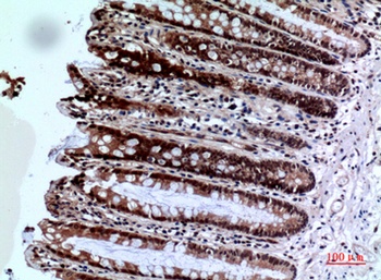 FOXP3 rabbit pAb Antibody