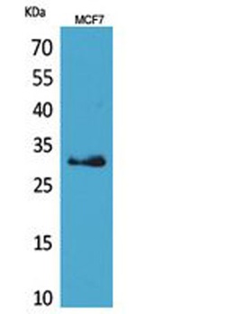 KLK1 rabbit pAb Antibody